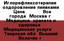 Иглорефлексотерапия, оздоровление пиявками › Цена ­ 3 000 - Все города, Москва г. Медицина, красота и здоровье » Медицинские услуги   . Тверская обл.,Вышний Волочек г.